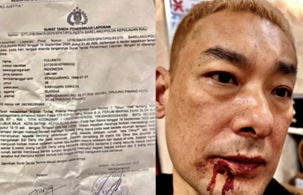 Empat Bulan Penyidikan, Kasus Dugaan Pengeroyokan Uji Integritas Aparat